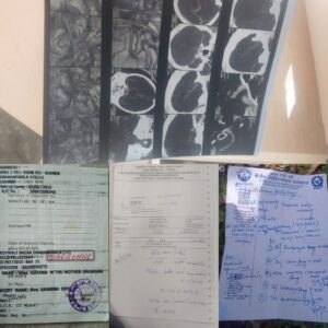 Kangra: 3 बेटियों की मां जिंदगी और मौत से लड़ रही, ब्रेन क्लॉट ऑपरेशन के लिए परिवार ने लगाई मदद की गुहार
