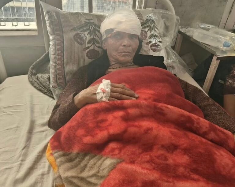 रामपुर में घर के अंदर घुसा तेंदुआ, 62 वर्षीय महिला पर किया जानलेवा हमला; सिर पर गंभीर चोटें, गांव में दहशत